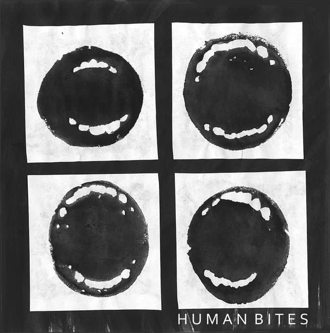 Human Bites