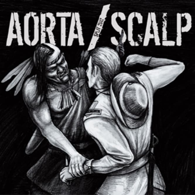 Aorta