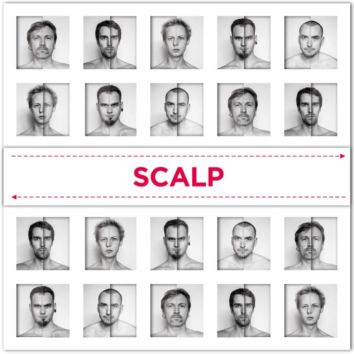 Obal alba SCALP / VICTIMS OF HATE